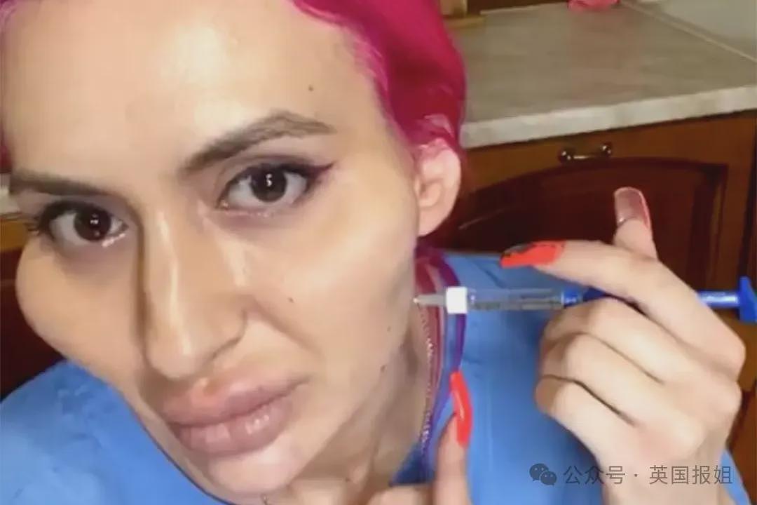 惊悚！乌克兰网红狂打玻尿酸整出外星脸，自称“世界最大脸颊”超自豪！网友：比鬼还吓人（组图） - 19