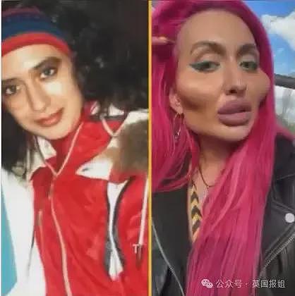 惊悚！乌克兰网红狂打玻尿酸整出外星脸，自称“世界最大脸颊”超自豪！网友：比鬼还吓人（组图） - 9