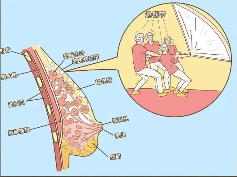 不穿胸罩悄悄流行，年轻女性选择“真空”生活（组图） - 17