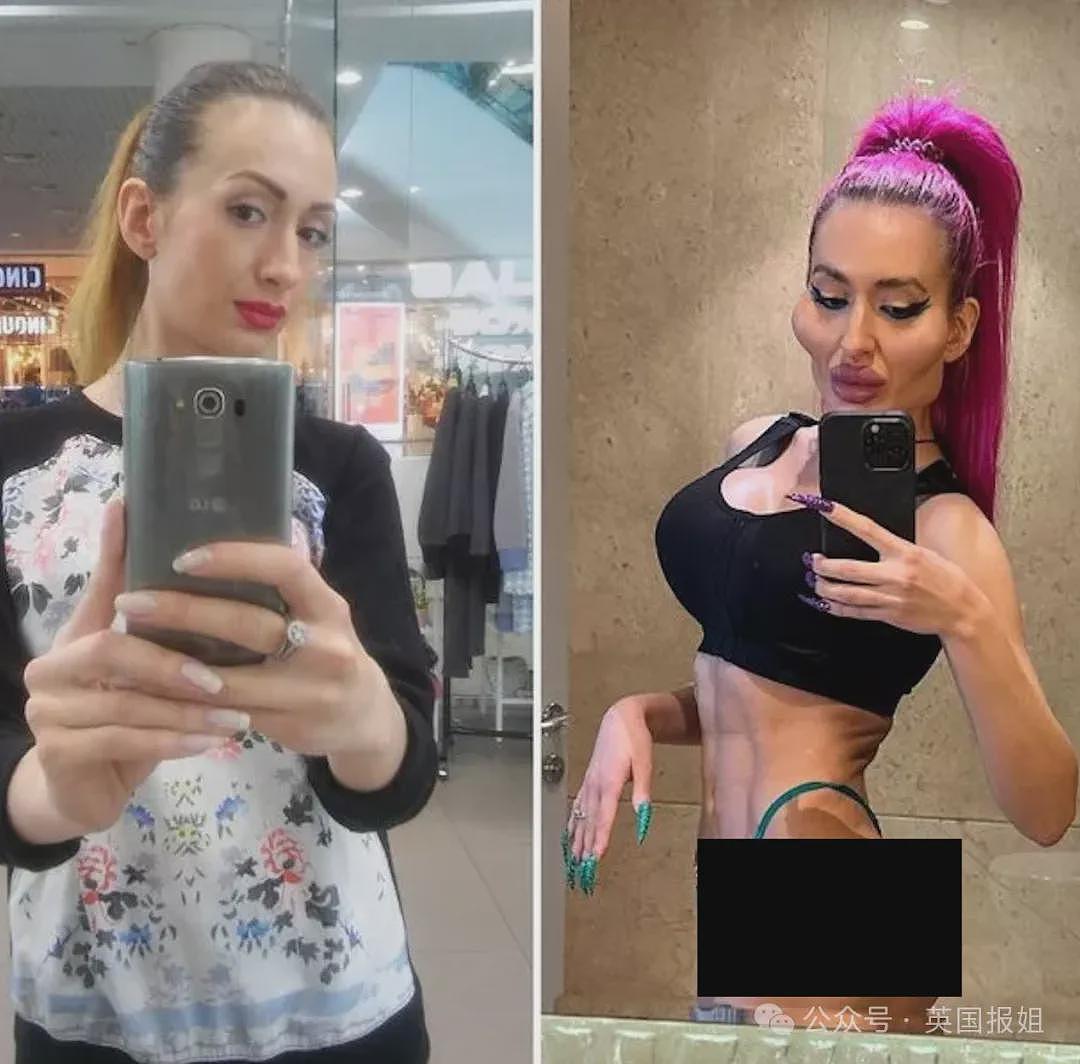 惊悚！乌克兰网红狂打玻尿酸整出外星脸，自称“世界最大脸颊”超自豪！网友：比鬼还吓人（组图） - 21