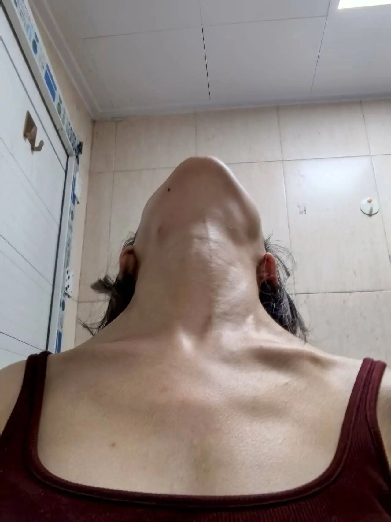 “仙女管”插胃,正毁掉年轻女孩(组图) - 30