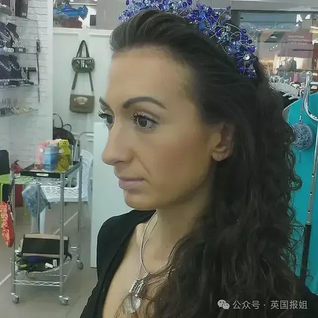 惊悚！乌克兰网红狂打玻尿酸整出外星脸，自称“世界最大脸颊”超自豪！网友：比鬼还吓人（组图） - 7
