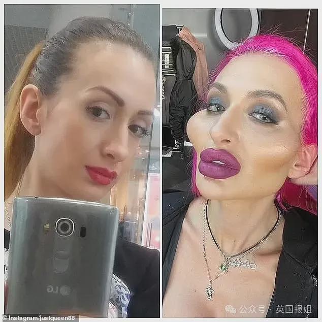 惊悚！乌克兰网红狂打玻尿酸整出外星脸，自称“世界最大脸颊”超自豪！网友：比鬼还吓人（组图） - 5