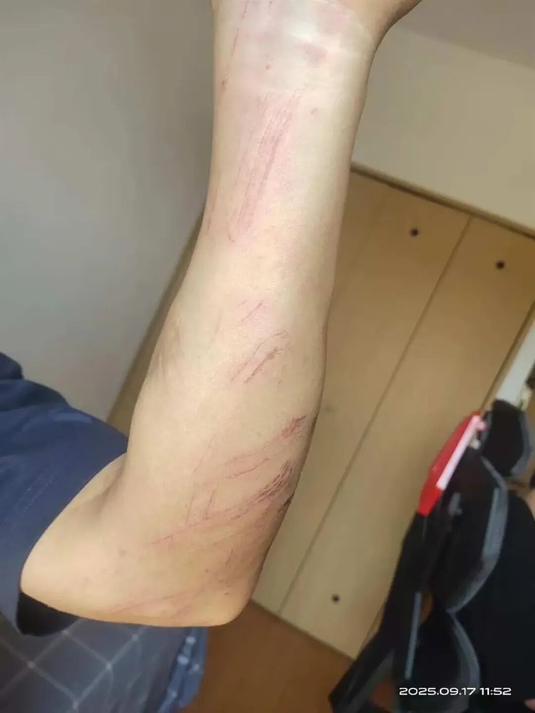 中国游客在日本爬峭壁勇救落水女子！本人发声：左手残疾，只能紧咬女子头发（组图） - 2