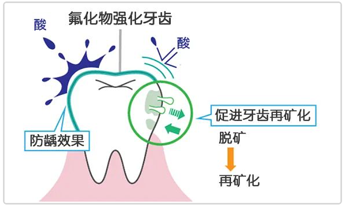 刷牙悄悄省去这个步骤，反而更防蛀！（组图） - 2