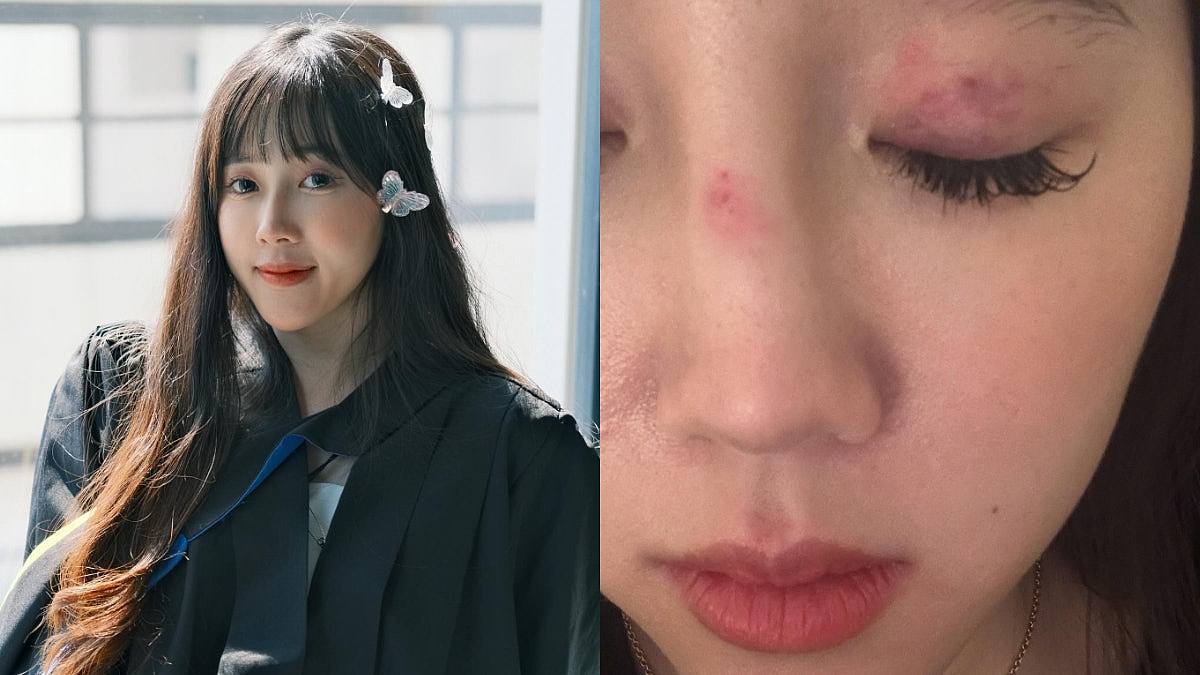 华女英国当街被4人围殴,倒地仍被用尽力狂踢,称当地人冷眼旁观(组图) - 1