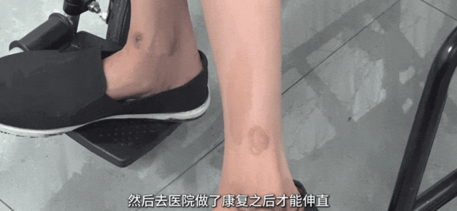 触目惊心！女子双腿被毁、尿失禁，竟还在贩卖！（组图） - 2