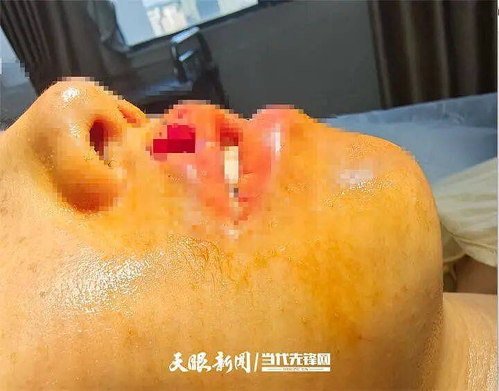 女子上门代喂,被100多斤阿拉斯加犬咬伤遭毁容,狗主人却称...(组图) - 4