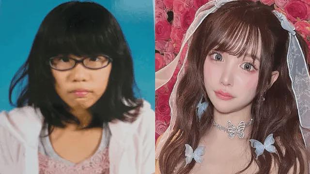 日本女子干8年苦力攒2600万整容换头！直言可爱的脸比铂金包珍贵，年轻就是最强武器！（组图） - 2