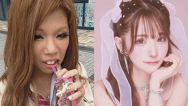 日本女子干8年苦力攒2600万整容换头！直言可爱的脸比铂金包珍贵，年轻就是最强武器！（组图） - 1