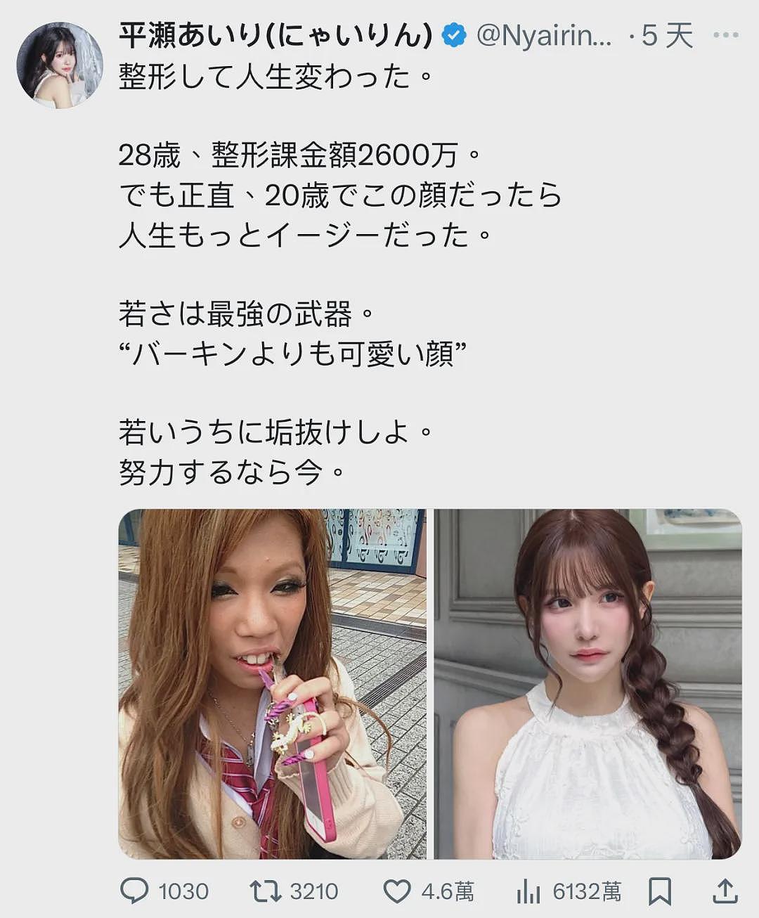 日本女子干8年苦力攒2600万整容换头！直言可爱的脸比铂金包珍贵，年轻就是最强武器！（组图） - 3