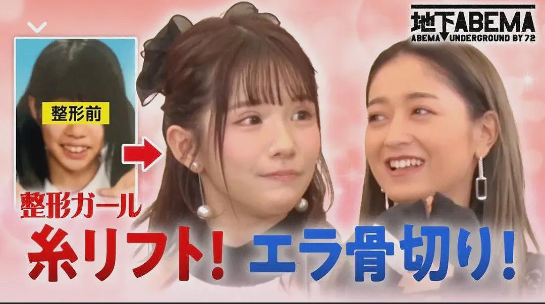 日本女子干8年苦力攒2600万整容换头！直言可爱的脸比铂金包珍贵，年轻就是最强武器！（组图） - 6