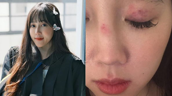 往死里打!台女英国遭4白人少女围殴扯头发, 当地人冷眼旁观(图) - 1