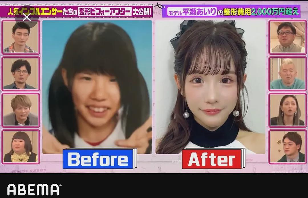 日本女子干8年苦力攒2600万整容换头！直言可爱的脸比铂金包珍贵，年轻就是最强武器！（组图） - 4
