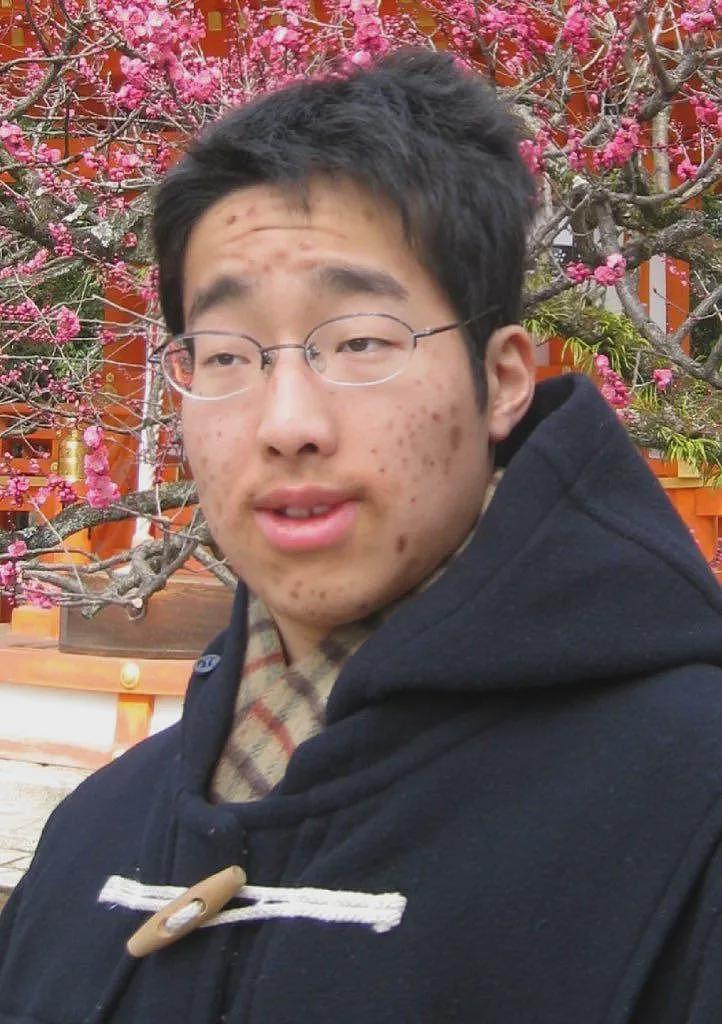 这同一个人？小哥曾满脸痘，是被霸凌的受气包，现在，他能cos美少女了（组图） - 4
