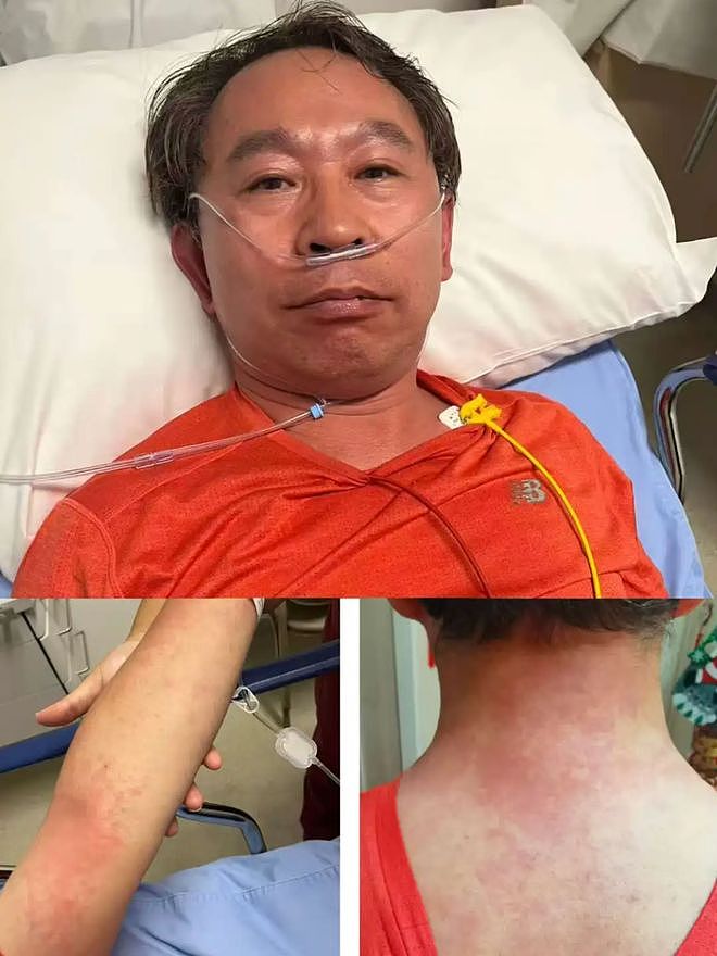 协和医生自述头孢过敏惊险经历，提醒大家：吃药一定注意这些事（组图） - 1