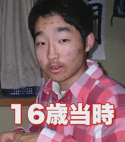 这同一个人？小哥曾满脸痘，是被霸凌的受气包，现在，他能cos美少女了（组图） - 3