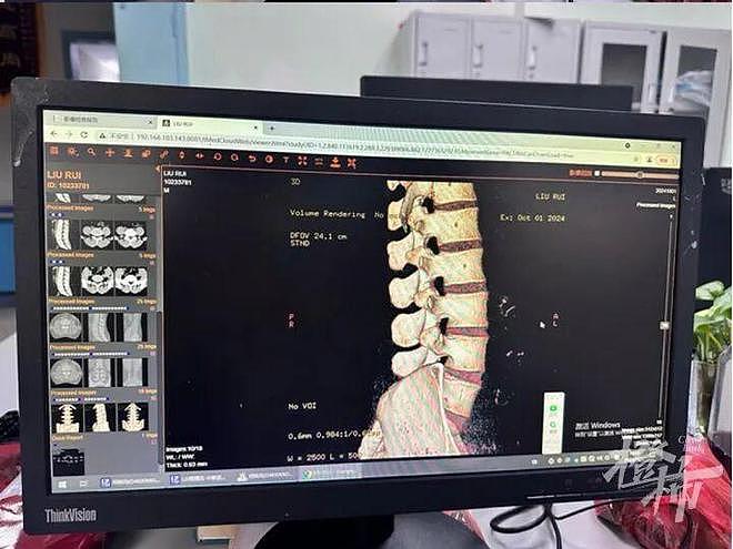 男子做了一个冲浪动作就永久瘫痪，女友发声（组图） - 1