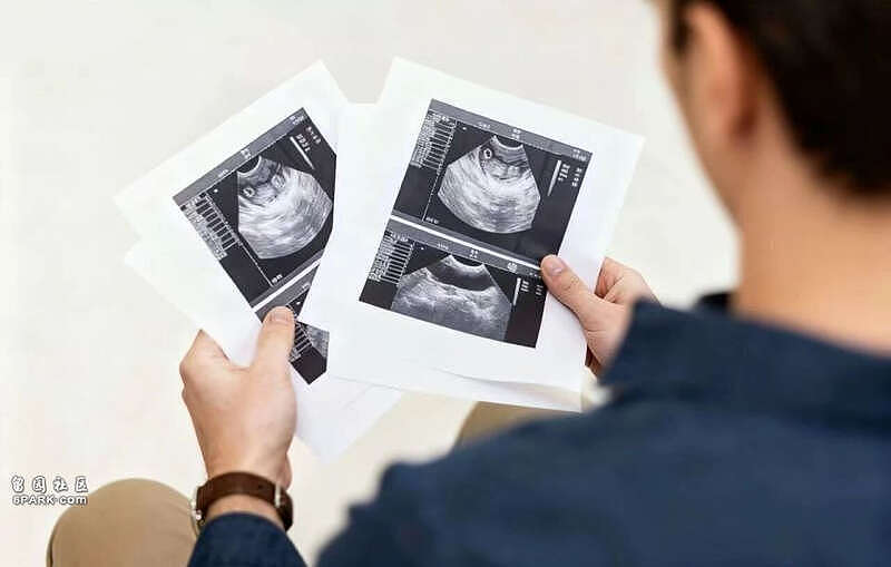 医生坦言：7种你以为的“大病”，其实不用担心（组图） - 1