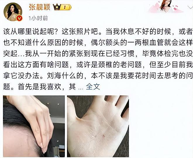 名利双收有什么用？张靓颖如今现状，给内娱的明星们敲响了警钟（组图） - 14