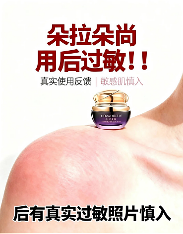 “脸肿到睁不开眼”,朵拉朵尚竟要医院开“质检报告”?(组图) - 1