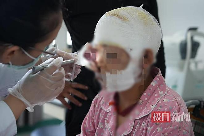 孕妇遭熊袭击装死保命：熊牙刺入右眼左耳，头部撕裂（组图） - 1