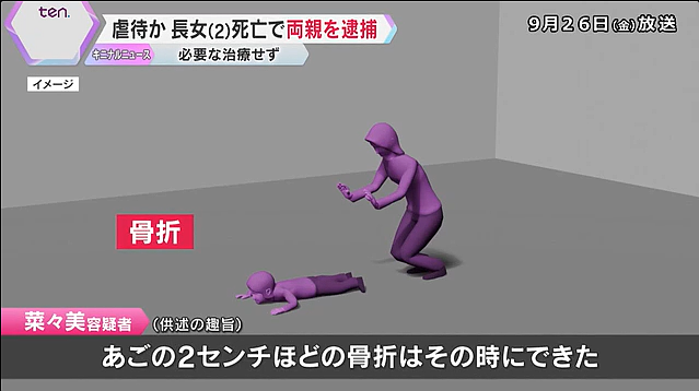 日本2岁女童遭亲生父母殴打致死，死前下巴骨折、体重仅6kg！恶魔妈还怀上了新孩子…（组图） - 3
