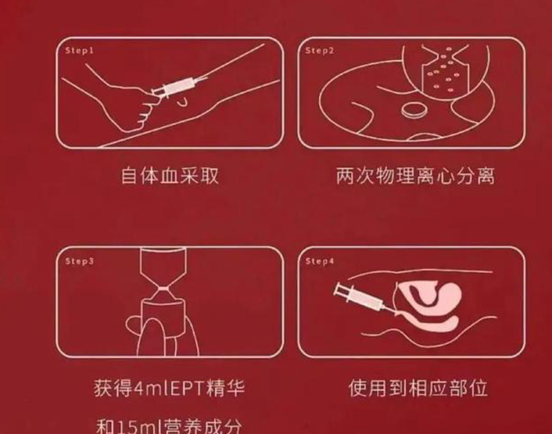 一针爽上天？私处“高潮针”爆火，背后真相不堪入目！网民：到底哪些人在用...（组图） - 5