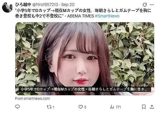 日本M罩杯樱花妹自曝成长阴影,缠胸才敢上学!十分困扰:真的很痛很痛(组图) - 5