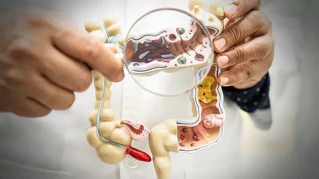 新西兰年轻人早发癌症激增，研究团队发现诱因“太常见”...（组图） - 10