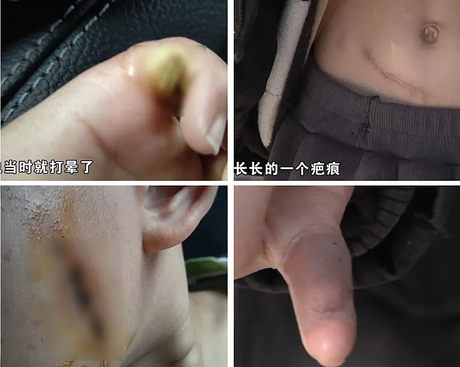 痛心！男孩小区内突然身亡，“儿子最后叫了一声妈妈...”！这个地方暗藏杀机，户外常见（组图） - 7