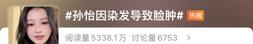 知名女星自曝，脸肿到没法见人！很多人假期前会做这件事，频繁接触有危害（组图） - 1