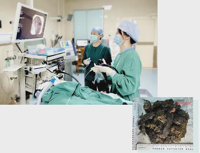 10岁女孩偷偷做这事!体内这一幕让医生惊呆,有人因羞耻感延误就医…(组图) - 4