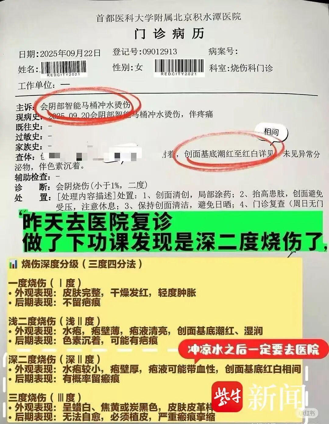 女子上厕所被烫到尖叫弹起，二度烧伤！很多人家里都在用（组图） - 5
