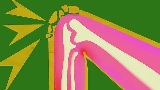 外媒：如何为你的膝盖做好未来的防护（组图） - 1