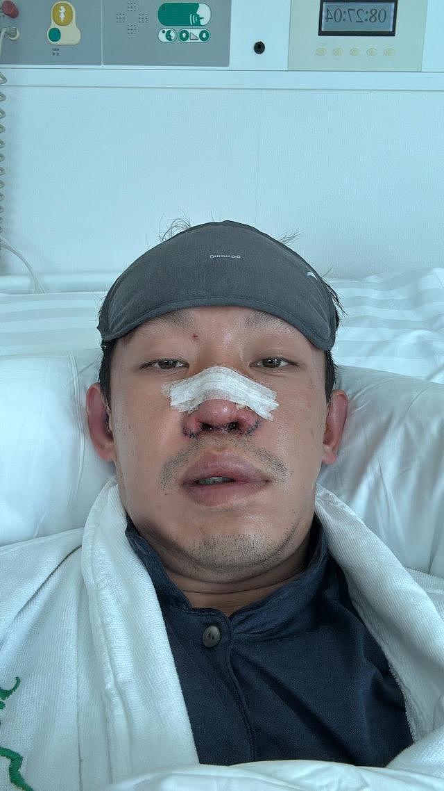 香港富二代遭车祸严重毁容，近照面目全非，曾找十多位医生修复（组图） - 6