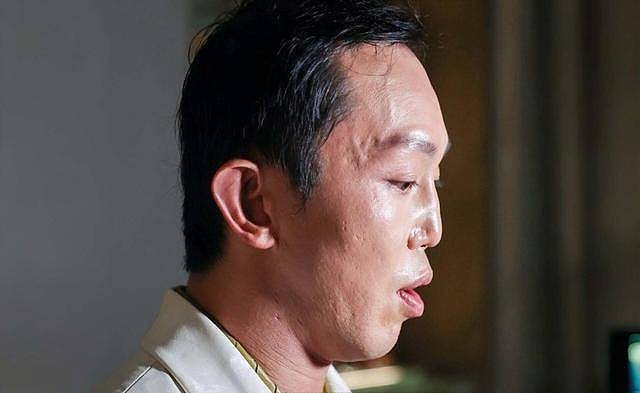 香港知名太子爷遇严重车祸,毁容后面部重建,至今不能大口吃饭(组图) - 4