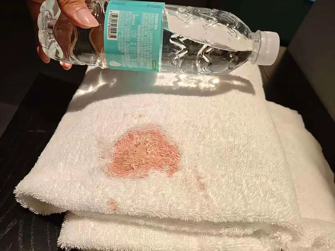 男子发现酒店浴巾有大片血迹，担心染病要求赔偿！酒店质疑：血迹非常新鲜，网友热议（组图） - 1
