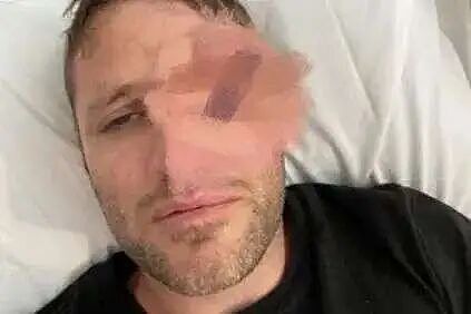 可怕！澳洲爸爸因孩子玩具，险些丧命！昏迷2周，最终永远失去左眼...（组图） - 1