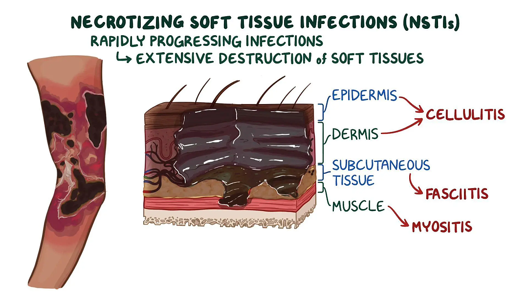 可怕！澳洲爸爸因孩子玩具，险些丧命！昏迷2周，最终永远失去左眼...（组图） - 8