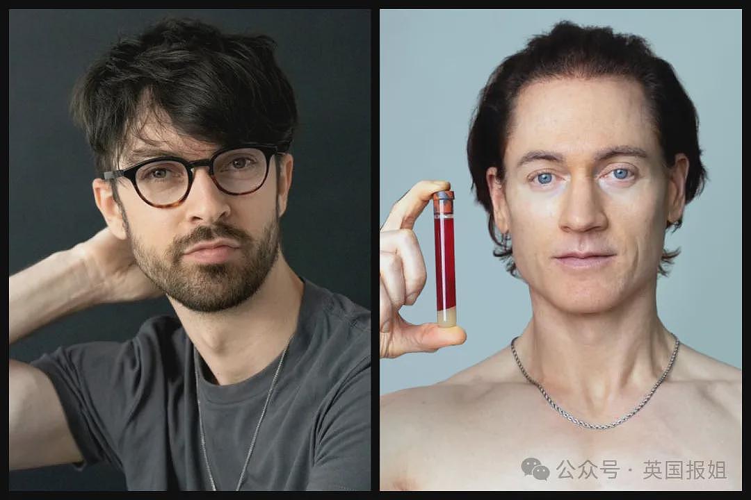 亿万富翁“换血哥”偷打减肥针老了10岁？自曝每天冰敷丁丁、冲击波虐全身，前员工：效果反噬了（组图） - 19
