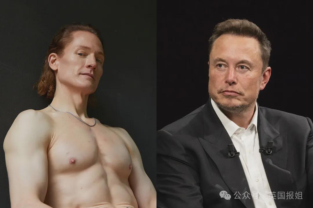 亿万富翁“换血哥”偷打减肥针老了10岁？自曝每天冰敷丁丁、冲击波虐全身，前员工：效果反噬了（组图） - 15