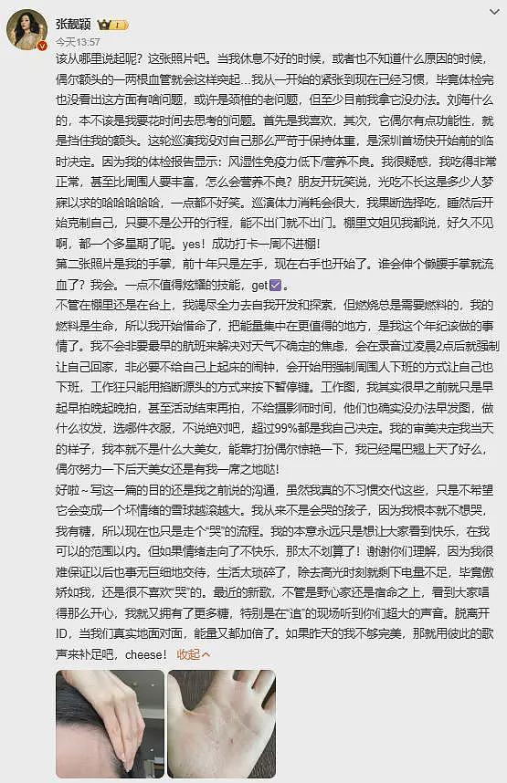 2米高台直坠!41岁张靓颖生日演唱会摔出尖叫,爬起笑称 “老当益壮”(组图) - 4