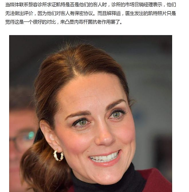 凯特王妃变相承认打了肉毒!为了形象没办法(组图) - 7