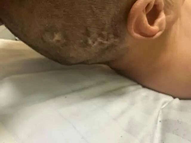 4名游客遭马蜂袭击送医抢救，游客：没设警示牌（组图） - 1