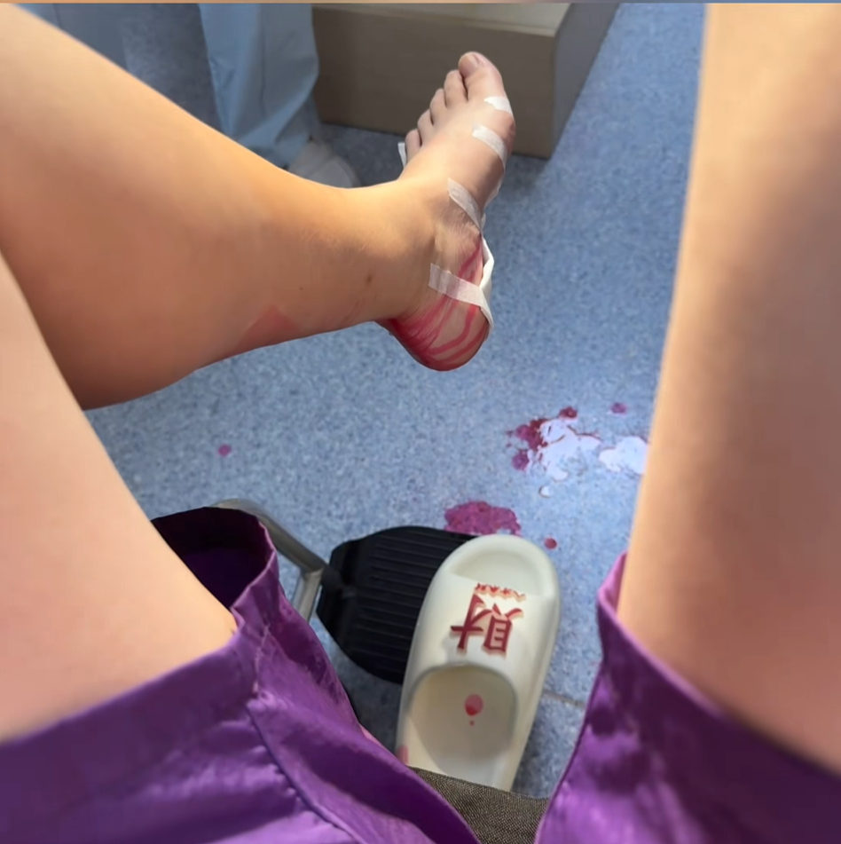 上海女子突然脚底喷血,紧急送医!这东西很多人在用,有人称“一个月瘦20斤”…(视频/组图) - 5