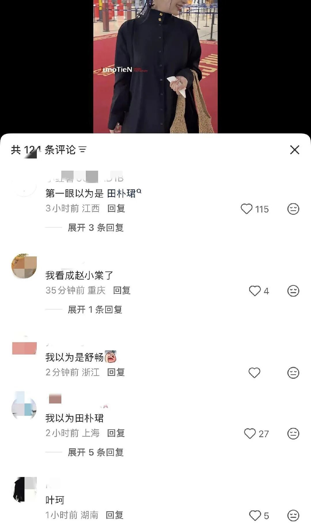 又一女星整容失败毁容了？机场路透判若两人，为翻红真拼了（组图） - 1