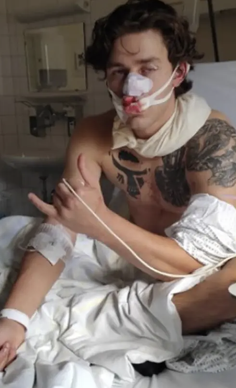 好心遭横祸！帅男模救人惨被毁容，捅成血人！歹徒抓了又放，全网震怒（组图） - 5