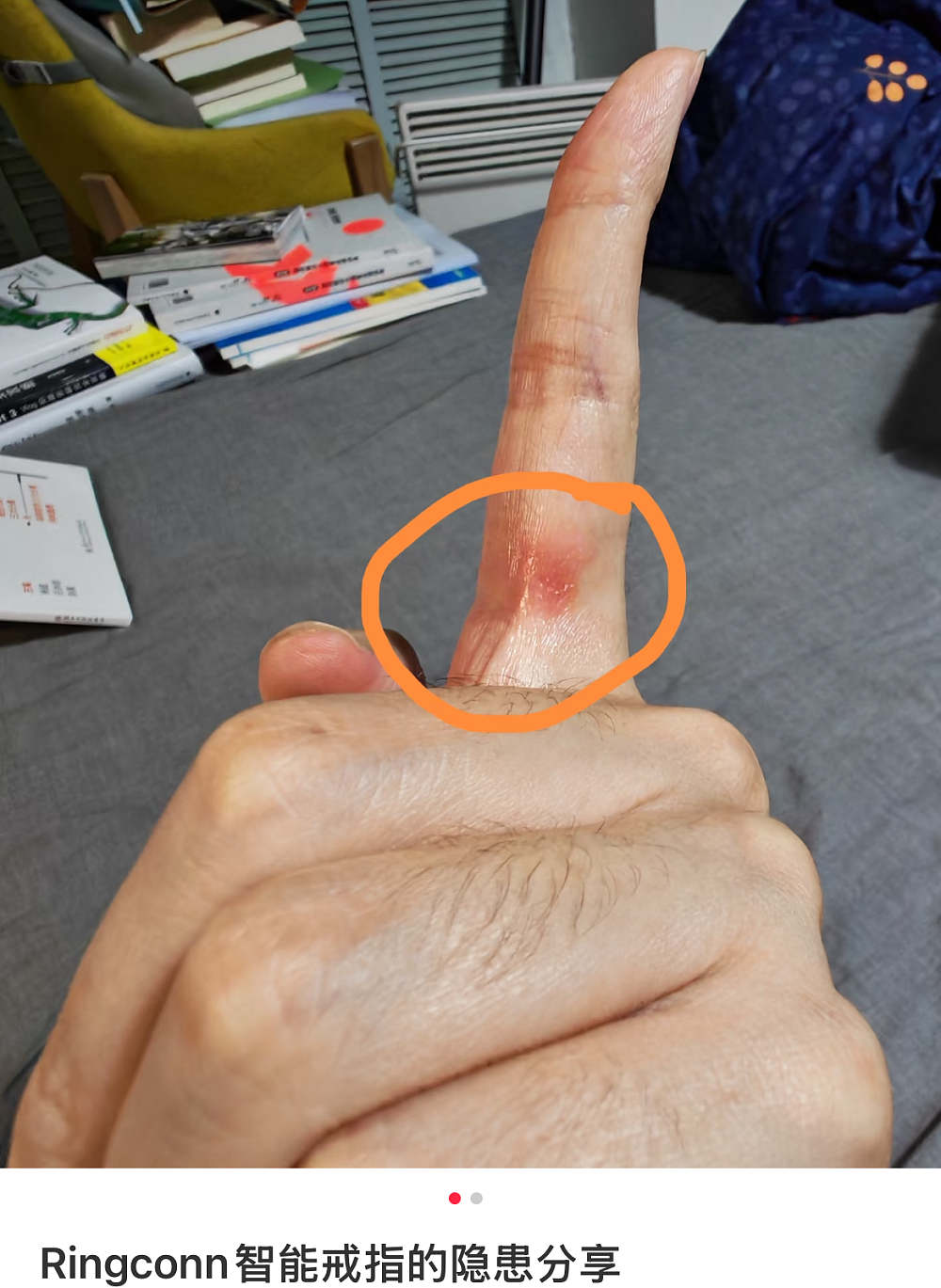 3000买的“电子废物”抽风差点把手指勒淤血，手上戴这个才算赛级纯种金融男？（组图） - 7