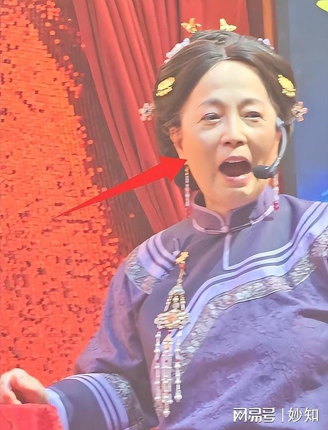 62岁“石榴姐”苑琼丹近况曝光，生图下人老皮松，木偶纹好抢镜（组图） - 11